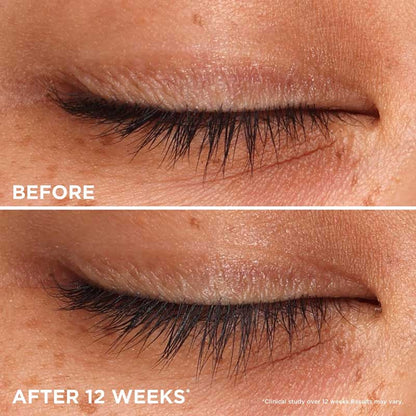 Benefit | Whoop Lash | gentle | conditioning | lash-enhancing serum | fuller | thicker | longer | clinically tested |  transform | healthier | nourished